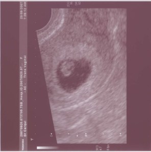 5 weeks, 6 days gestation